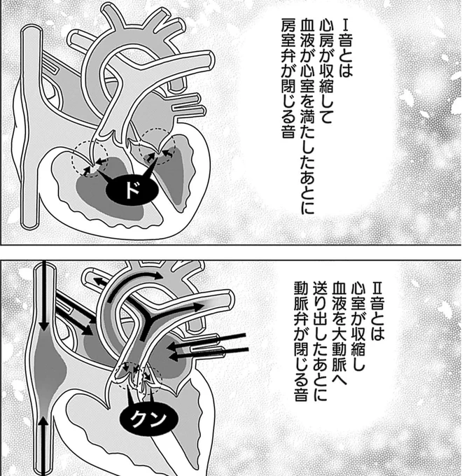 【心音は実は異なる二つの音から成る。よく言われる「ドクンドクン」はI音の「ド」とⅡ音の「クン」に分けられるって話】
(0/5) 