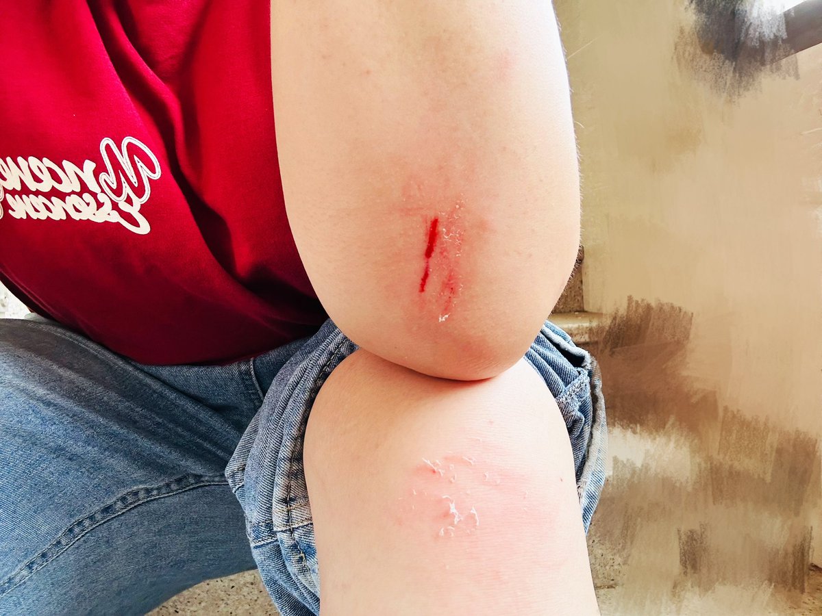 我真心好想凿开推着婴儿车鬼探头的家长的脑子看看里面到底是不是空的🤬🤬🤬🤬
DKLM🤬🤬🤬