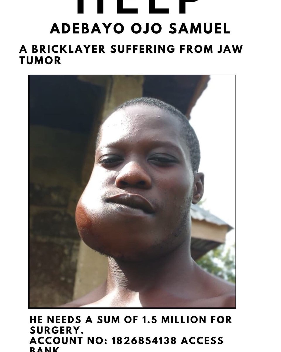Ammmeenah's tweet photo. Please donate anything you can we are yet to receive anything. Please help rt
@Jollof101 @Wizarab10 @Rene_noire @Jemeelahh_ @Morris_Monye @DONJAZZY https://t.co/yyVMg9mosS