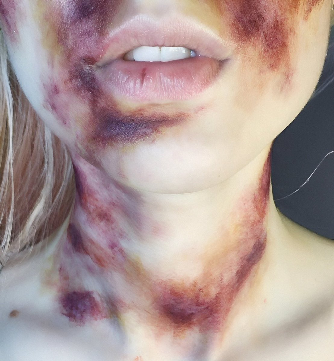 𝑴𝒊𝒎𝒊𝒌𝒚𝒖 𝒊𝒔𝒏'𝒕 𝒂𝒃𝒖𝒔𝒊𝒗𝒆, 𝒊𝒕'𝒔 𝒋𝒖𝒔𝒕 "𝗧𝗢𝗨𝗚𝗛 𝗟𝗢𝗩𝗘".

𝑬𝒙𝒕𝒓𝒆𝒎𝒆𝒍𝒚 𝑻𝒐𝒖𝒈𝒉, 𝑽𝒊𝒐𝒍𝒆𝒏𝒕 𝒂𝒏𝒅 𝑴𝒖𝒓𝒅𝒆𝒓𝒐𝒖𝒔 𝑳𝒐𝒗𝒆.