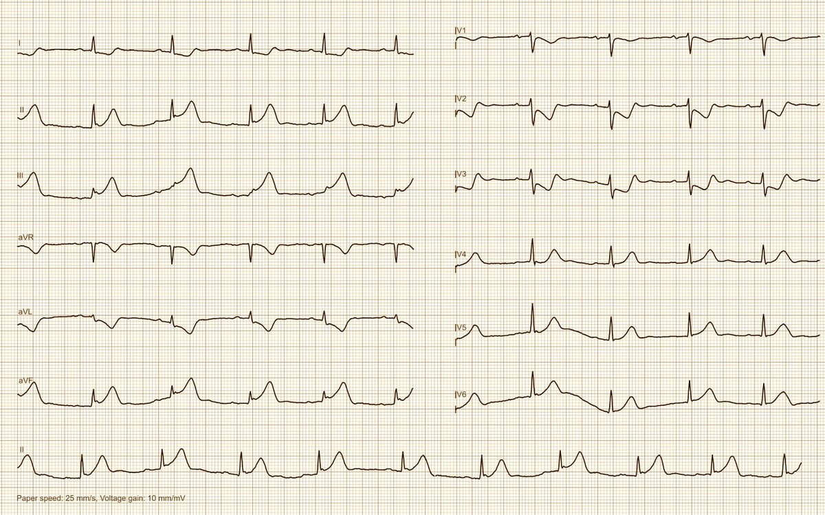 Simple but beautiful, diagnosis?