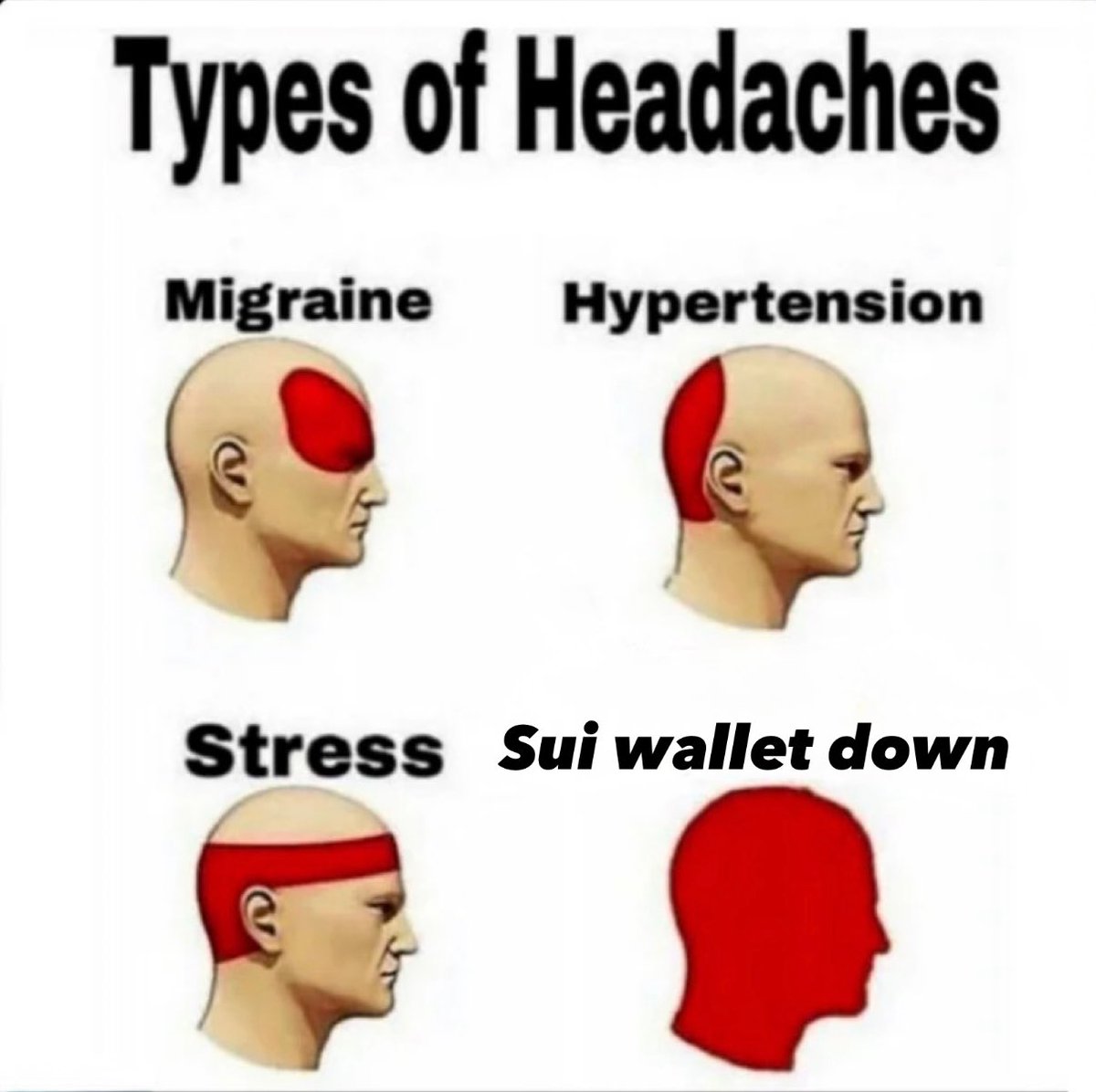 GM
