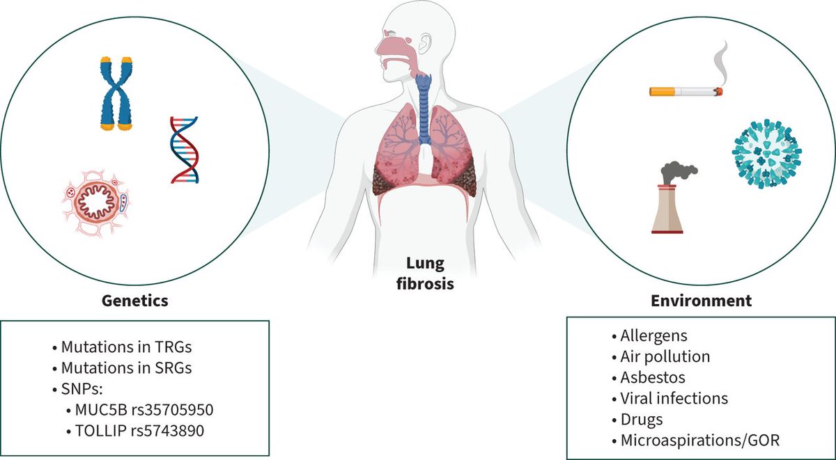 ERSpublications's tweet photo. Breathe: This review summarises interesting insights into interstitial lung disease pathogenesis from a translational science point of view @3Assembly @ERSpublications @EuroRespSoc @EarlyCareerERS @SaraOcana1 https://t.co/jw5HdhHOMJ https://t.co/CR9YgQridu