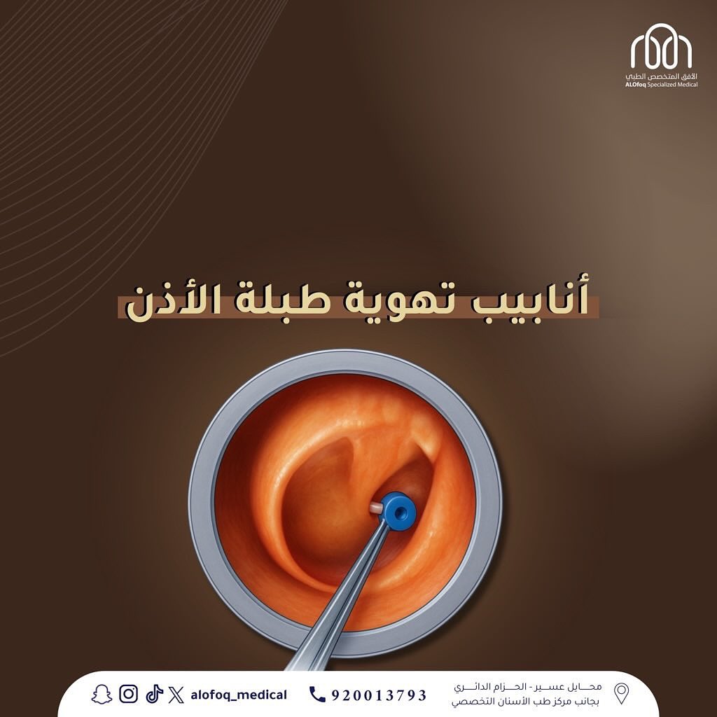 تعتبر تركيب أنابيب تهوية الطبلة مناسبة للحالات التي تعاني من :

• التهابات أذن وسطى مزمنة أو متكررة 👂🏻
• تجمع السوائل خلف الطبلة 💧
• ضعف سمع مؤقت بسبب السوائل ! 

الحل بسيط والنتائج تفرق ✅✨

احجز استشارتك اليوم ☎️ 920013793
