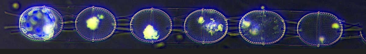 plancton_andino's tweet photo. Which position you prefer for a diatom images ? Horizontal or vertical ? #BloomPredictor #HAB #SAMS #phytoplankton #image #cell #ICHA2025 #PSMB #POAS #ADICFito #fjord #FAN #bioimaging #plankton @AlgaEnergy @AlgaeBase @PlanktonPundit @JPhycology @digitalocean @BDBiosciences @PhycoTerra @OregonState @comounpescado @Cooperativa @aslo_org @min_ciencia @WBDSLA
@Bio_Research @Bio_comunidad @DOCEUdeC