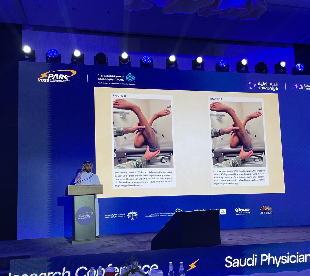 Thank you, Dr. Hareth Al Majid, for the excellent presentation on Lower Extremity Abnormalities in Children. A clear, clinically focused talk that enhanced our approach to pediatric musculoskeletal concerns. 🦵👶  #SPARC #SPARC2025