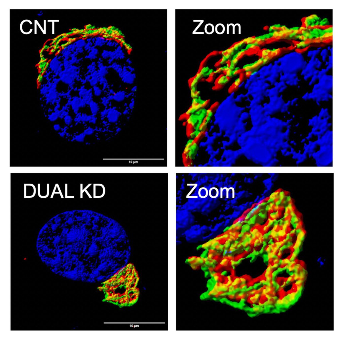 Tushar Sherkhane (@tush96rkhane) on Twitter photo Check this preprint from the lab.
<a href="/AntaraC9/">Antara Chakraborty</a>, Kinesin and Dynein work to regulate the Golgi organisation and function.
doi.org/10.1101/2025.0⦠Check this preprint from the lab.
<a href="/AntaraC9/">Antara Chakraborty</a>, Kinesin and Dynein work to regulate the Golgi organisation and function.
doi.org/10.1101/2025.0ā¦