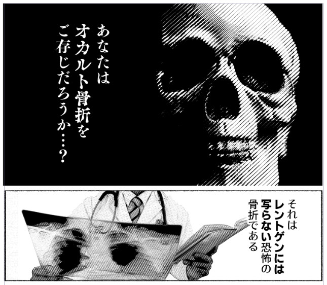 捻挫かと思ったら骨折だった話、もう漫画にして昇華するしかねえの気持ちになったのでレポ描いてる(画像はネームです 
