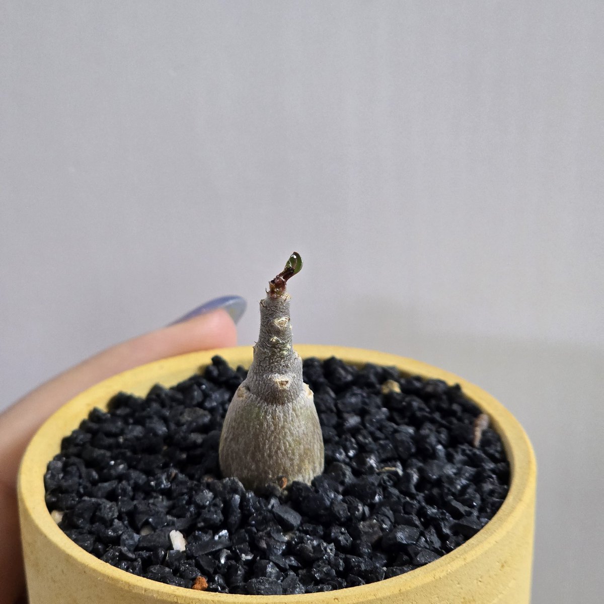 오베숨 드디어 탈모 탈출!!