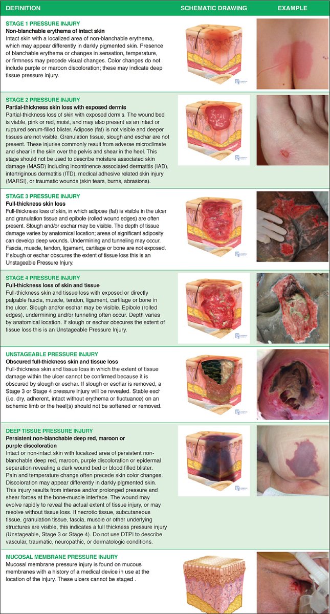 Singapore Medical Journal (SMJ) (@smj_sg) on Twitter photo Bedridden patients are increasing worldwide with our aging population. New #CME article in #SMJ by <a href="/lifeng_t/">Li Feng Tan</a> addresses this challenge with a multidisciplinary approach to prevent complications, initiate timely end-of-life discussions, and coordinate community resources. Bedridden patients are increasing worldwide with our aging population. New #CME article in #SMJ by <a href="/lifeng_t/">Li Feng Tan</a> addresses this challenge with a multidisciplinary approach to prevent complications, initiate timely end-of-life discussions, and coordinate community resources.