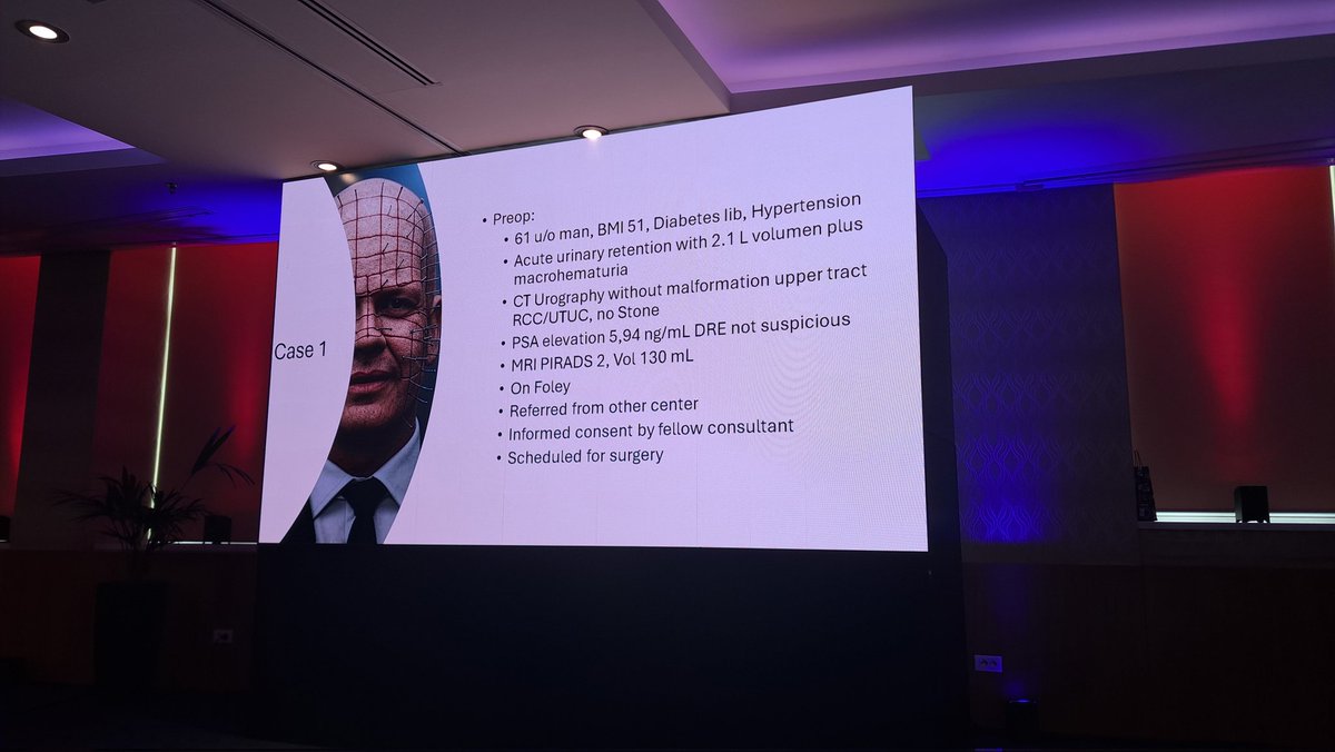 Thomas Tailly (@thomastailly) on Twitter photo Join us for the grand finale of #beam25.
Currently tackling BPH= big prostate horrors with <a href="/fgomsan/">Fernando GomezSancha</a> <a href="/FCAFigueiredo/">Felipe Figueiredo HoLEP 🇧🇷</a> <a href="/trwherrmann/">Thomas RW Herrmann</a> and <a href="/PieterUvin/">Pieter Uvin</a> . Later on the famous Balloon debate for stone 🪨 treatment. 🎈
Join on beam25.be/register Join us for the grand finale of #beam25.
Currently tackling BPH= big prostate horrors with <a href="/fgomsan/">Fernando GomezSancha</a> <a href="/FCAFigueiredo/">Felipe Figueiredo HoLEP 🇧🇷</a> <a href="/trwherrmann/">Thomas RW Herrmann</a> and <a href="/PieterUvin/">Pieter Uvin</a> . Later on the famous Balloon debate for stone 🪨 treatment. 🎈
Join on beam25.be/register