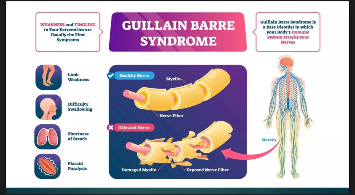 fems_ksu's tweet photo. 🚨 Neuro Red Flags!
From Dr. Albara’s  @albraahzamae powerful lecture:

🧠 MS: Progressive brain/spinal cord disease (EDSS scale tracks it).
⚡️ GBS: Sudden immune attack on nerves can lead to paralysis &amp; breathing failure.

⏱ Early detection saves lives.
Thank you, Dr. Albara!🙏 https://t.co/mYRhuOS5as