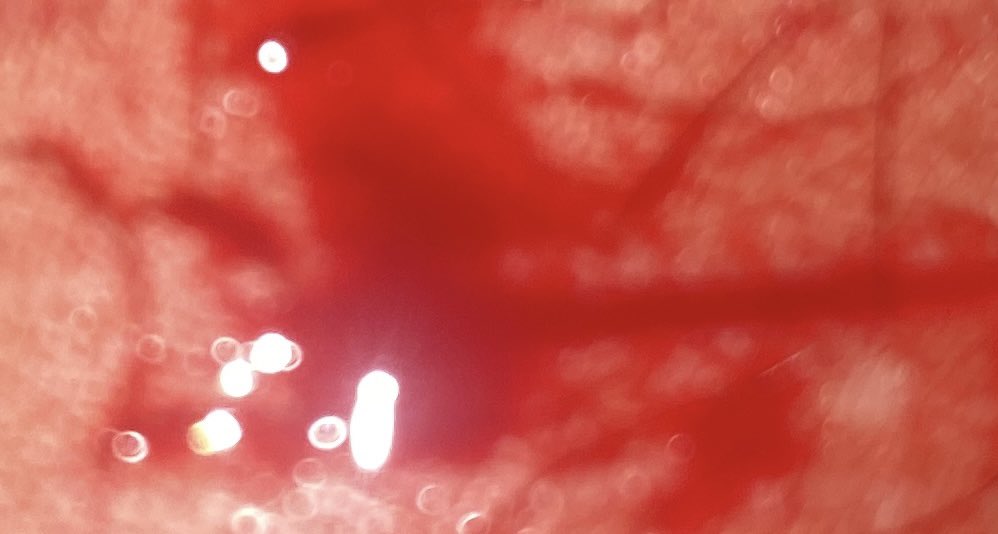 den_down0's tweet photo. Blood blood blood https://t.co/Ehe9qot0fP