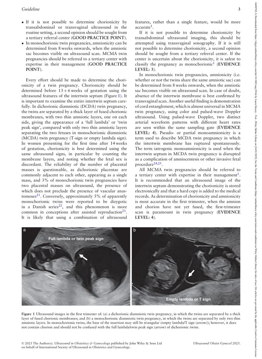 JezidMiranda's tweet photo. The new @ISUOG 2025 Twin Pregnancy Guidelines are a much-needed update in a field where practice often outpaces protocol. 

Clear, evidence-based, and globally relevant-an essential step toward improving outcomes in twin gestations. 

👏 Thanks to the authors and contributors. https://t.co/MctGB4grv1
