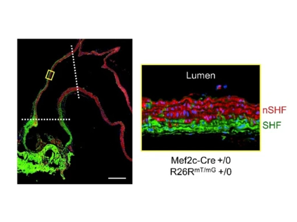 Ito, S., Graf, D.B., Katsumata, Y. et al. Smooth muscle cells and fibroblasts in the ascending aorta exhibit minor differences between embryonic origins in angiotensin II-driven transcriptional alterations. Sci Rep 15, 16617 (2025). doi.org/10.1038/s41598…