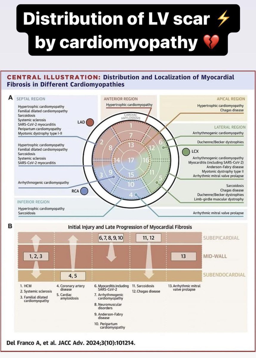CardiacTrials's tweet image. Distribution of LV scar in different cardiomyopathies 📚 

JACC Advances 2024 ♥️