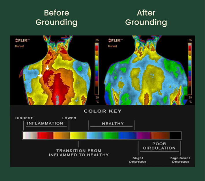 CraigBrockie's tweet photo. Grounding is the most powerful &amp; life-changing therapy straight from the Earth.

It’s 100% natural, non-invasive, therapeutic, and completely FREE.

No pills, no gimmicks. Based on scientific studies.

If you’re not grounding yet, you’re robbing your mind &amp; body. Here’s why: 🧵 https://t.co/kvMpgjlTSt