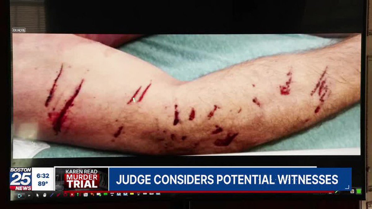 These patterned marks didn’t come from
 plastic taillight slicing thru John O’Keefe’s two shirts… pass it on. 

#FreeKarenRead