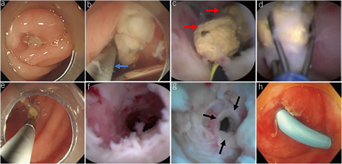 AJG - The American Journal of Gastroenterology tweet media