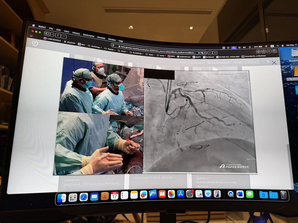 jedicath աǟզǟʀ.ǟɦʍɛɖ (@jedicath) on Twitter photo Spending the weekend watching CTO-flix. Live case recordings from the German CTO meeting. Perfect live case operation with one person speaking, commenting and deflecting the panel babble (<a href="/SmithElliotjs/">Elliot Smith</a>) while the operator just works (Mohammad Ayoub). They don’t stop the action Spending the weekend watching CTO-flix. Live case recordings from the German CTO meeting. Perfect live case operation with one person speaking, commenting and deflecting the panel babble (<a href="/SmithElliotjs/">Elliot Smith</a>) while the operator just works (Mohammad Ayoub). They don’t stop the action