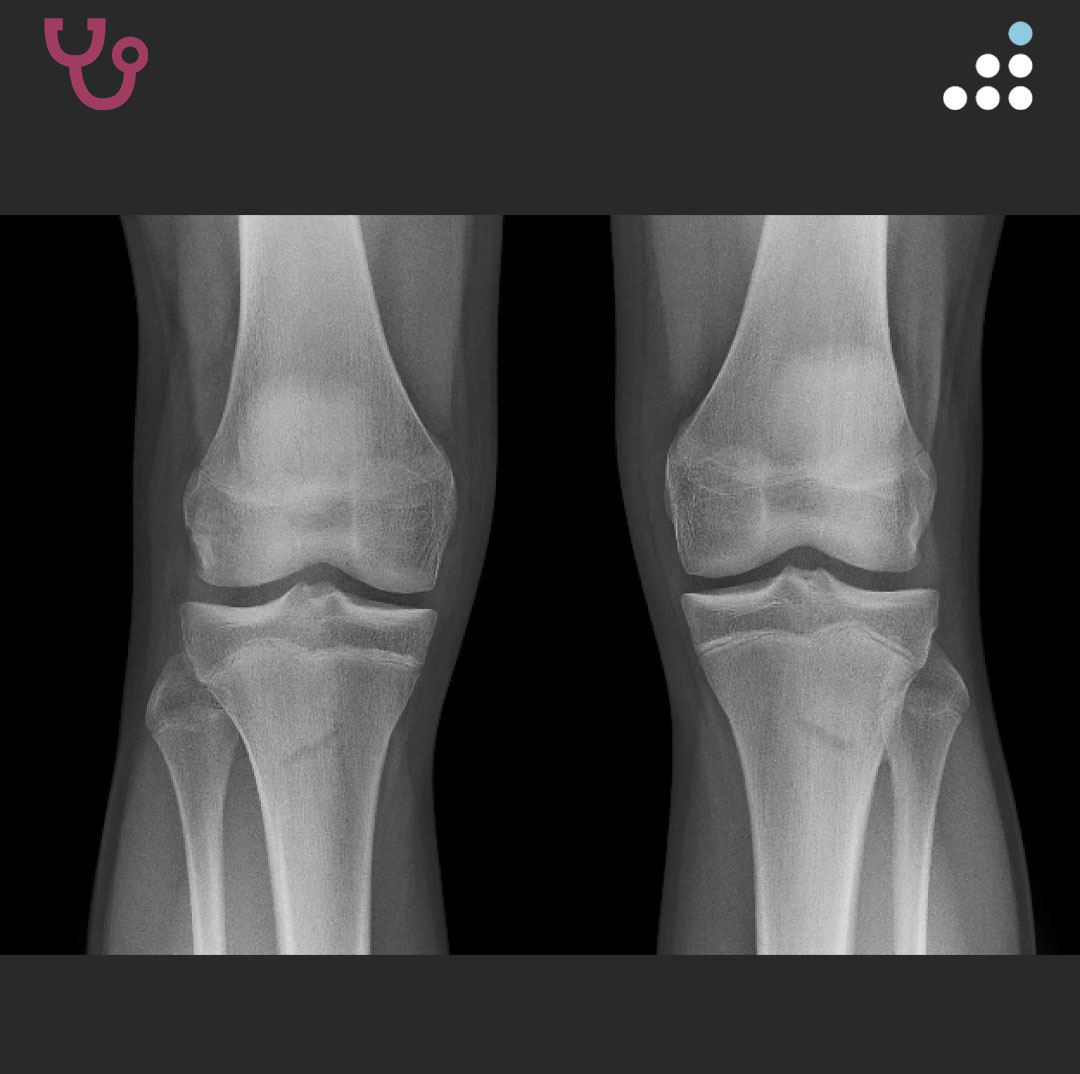 Orthobullets tweet media