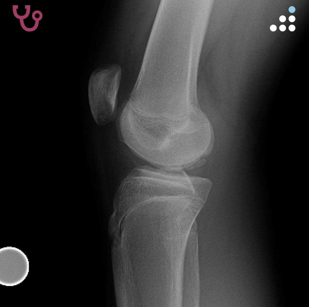 Orthobullets tweet media