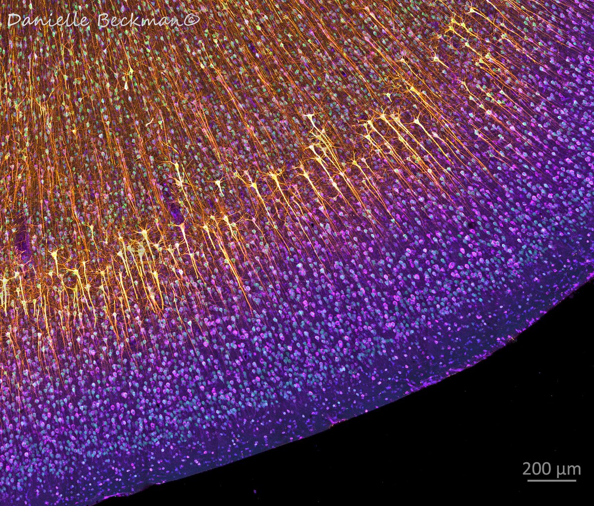 This #FluorescenceFriday became a #SynapticSaturday! Checking the expression of different proteins in the neocortex. 4 markers below: SMI32🟡 for the large pyramidal neurons, calbindin, a calcium-binding protein in 🟣, Neun for neuron nuclei in 🟢. Dapi 🔵for nuclei of all cells.