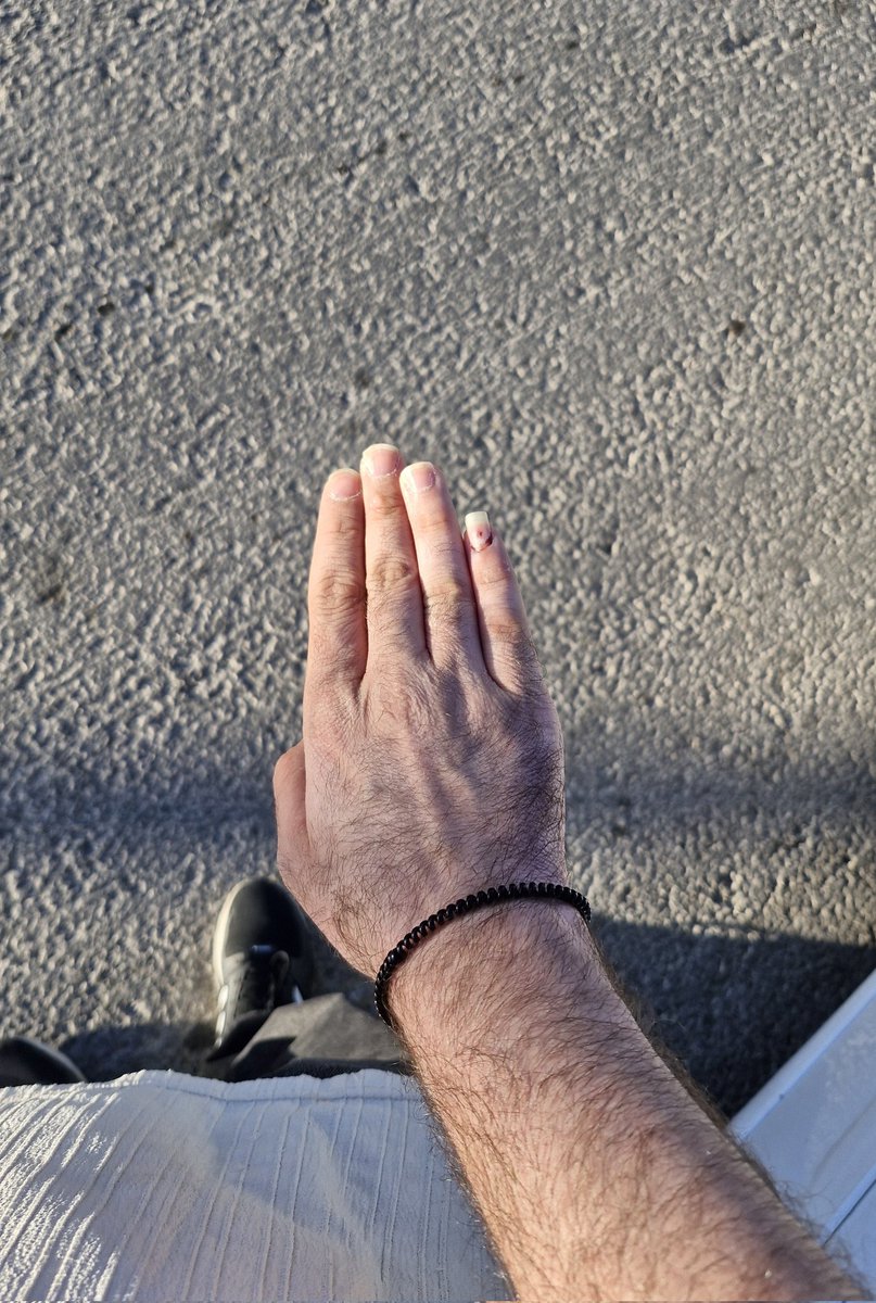 بعد از ۲۰ روز و عوض کردن سه گچ بالاخره اوکی شد و بسی بسیار خوشحالم ولی از من خوشحال تر بابت این باز گشایی دوستان و هم خوابگاهی های عزیزن