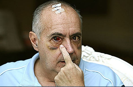 Albania nos ha dado 10 puntos, pero a José Luis Moreno le dieron 37 #EurovisionRTVE