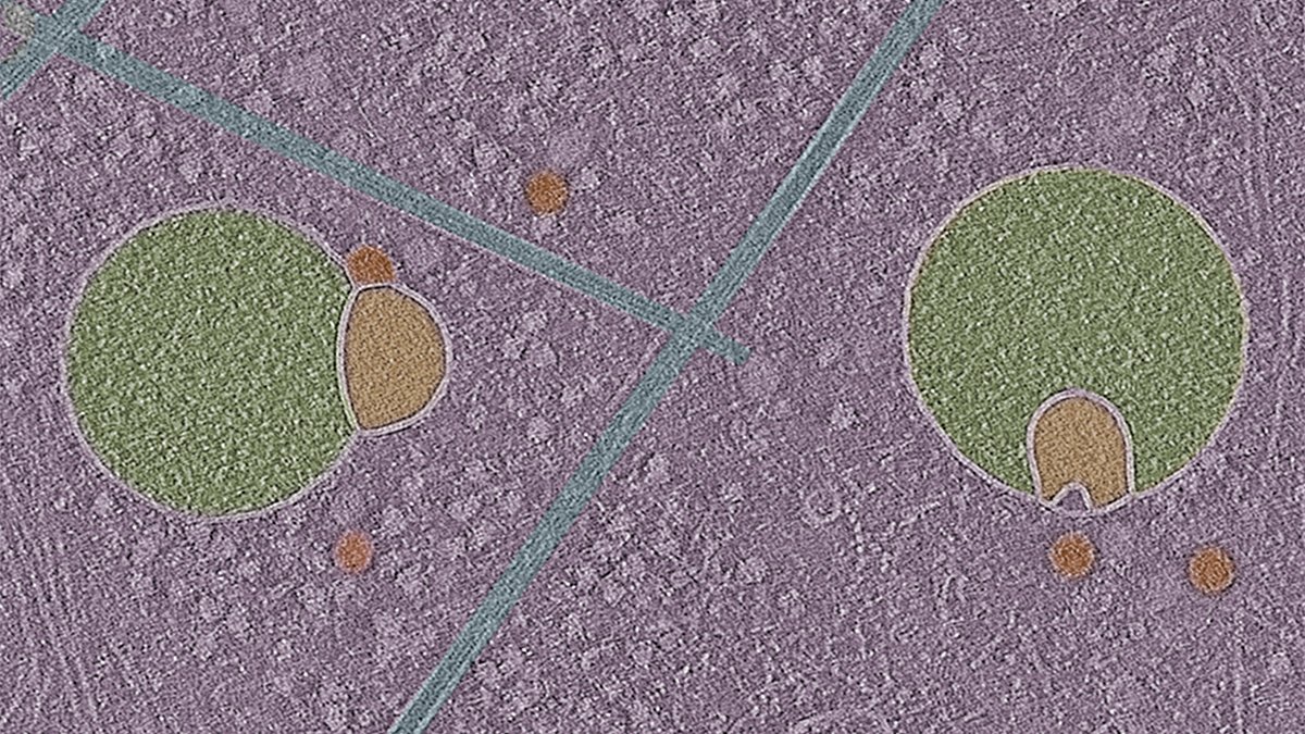 sehamebrahim's tweet photo. Early for #MicroscopyMonday:  #Hemifusomes- Newly discovered ESCRT-independent intermediates of intraluminal vesicle and multivesicular body formation!
In collaboration with @BecharaKachar Lab @NIH 
@NatureComms: https://t.co/Wpqbjp7fAQ
#cryoET #trafficking #organelle #hemifusion https://t.co/POnk6h6Nkc
