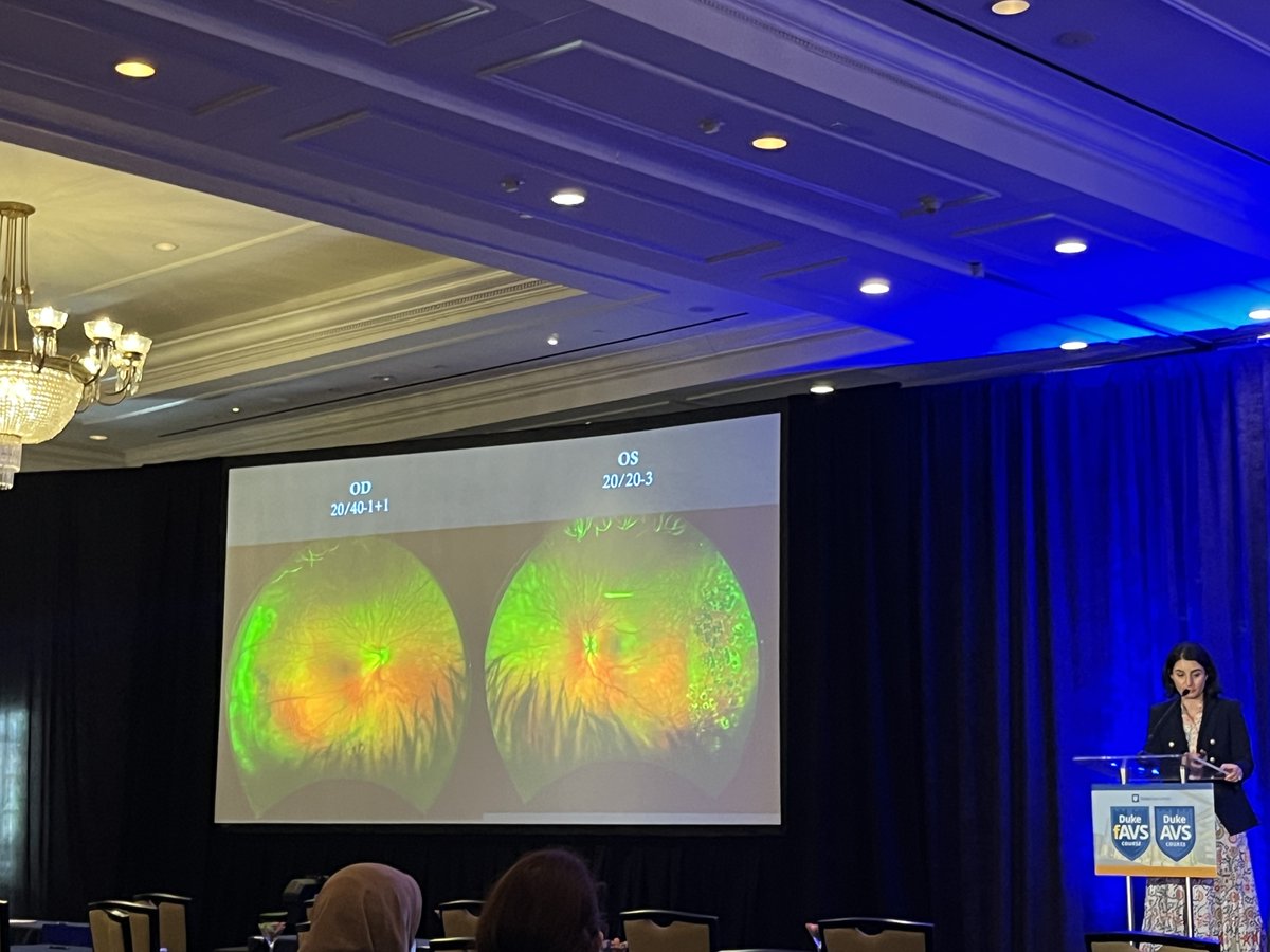 Retina Today (@retinatoday) on Twitter photo Course Director Lejla Vajzovic, MD, FASRS, took to the stage to share her insights into pediatric retinal diseases in adulthood—ROP, FEVR, and Stickler syndrome. <a href="/dukeeyecenter/">Duke Eye Center</a> <a href="/YoungMDConnect/">YoungMD Connect</a> <a href="/DukeMedSchool/">Duke University School of Medicine</a> #retina #AVS2025 Course Director Lejla Vajzovic, MD, FASRS, took to the stage to share her insights into pediatric retinal diseases in adulthood—ROP, FEVR, and Stickler syndrome. <a href="/dukeeyecenter/">Duke Eye Center</a> <a href="/YoungMDConnect/">YoungMD Connect</a> <a href="/DukeMedSchool/">Duke University School of Medicine</a> #retina #AVS2025