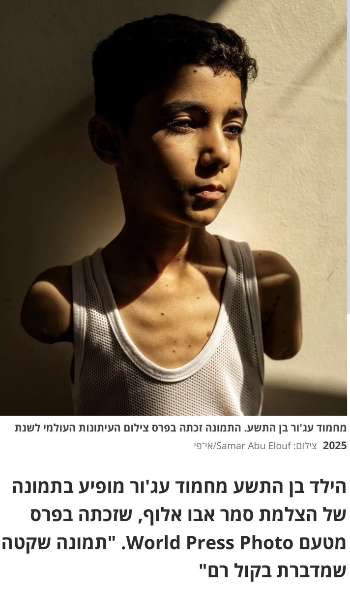 Geçen aylarda Dünya Basın Ödülü’nü kazanan fotoğraf seçildi.
Seçilen fotoğraftaki Filistinli çocuğa verseniz bu ödülü, hangi eliyle tutacak? Milyonlarca ödül onun bir tırnağını geri getirmez
Günümüz dünyası, bu çocuğu elsiz bırakıp; sonra da fotoğrafa ödül verecek kadar alçaktır