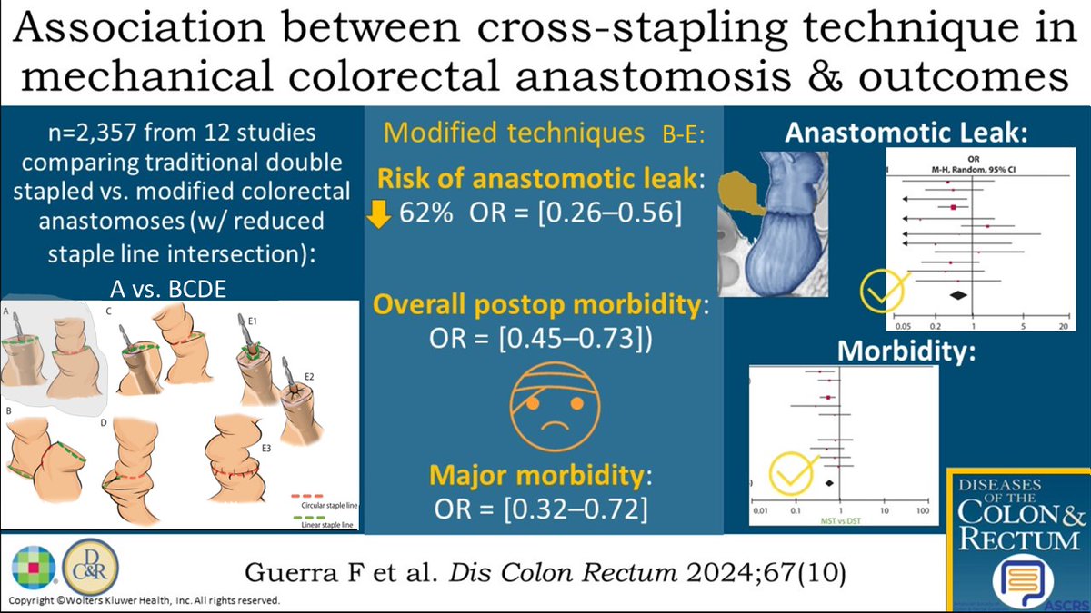 DCRjournal's tweet photo. #DCRJournal Visual Abstract recap | Association between cross-stapling technique in mechanical colorectal anastomosis &amp; outcomes: https://t.co/45g5p9bgPa https://t.co/3L7zMf3byD