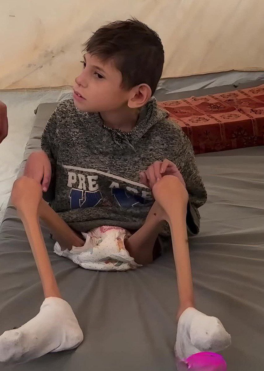 Peki ya çocuğuna su veremeyen,
Bir ekmek kırıntısı dahi bulamayan,
Kollarında her gün çocuğunun biraz daha eriyen bedenini gören Filistinli baba ne hissediyor, nasıl bir acı çekiyordur?

---