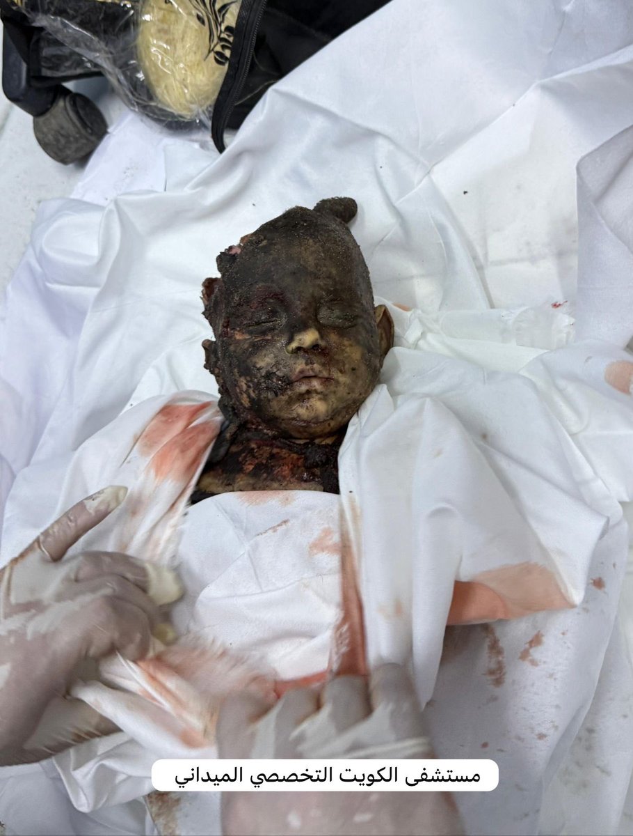 Abdulwahab Shajaa (@shgaastar) on Twitter photo <a href="/swilkinsonbc/">Sarah Wilkinson</a> The Nazi Israeli army and its satanic government burned the children of Gaza, killed the children of Gaza, displaced the children of Gaza, destroyed the children of Gaza, and the humanitarian West did not lift a finger against Israel. Where is justice? <a href="/swilkinsonbc/">Sarah Wilkinson</a> The Nazi Israeli army and its satanic government burned the children of Gaza, killed the children of Gaza, displaced the children of Gaza, destroyed the children of Gaza, and the humanitarian West did not lift a finger against Israel. Where is justice?