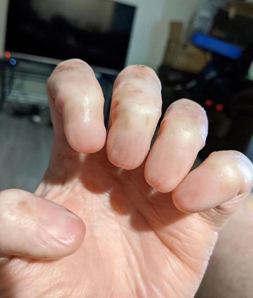 fuck man I gotta stop biting my nails