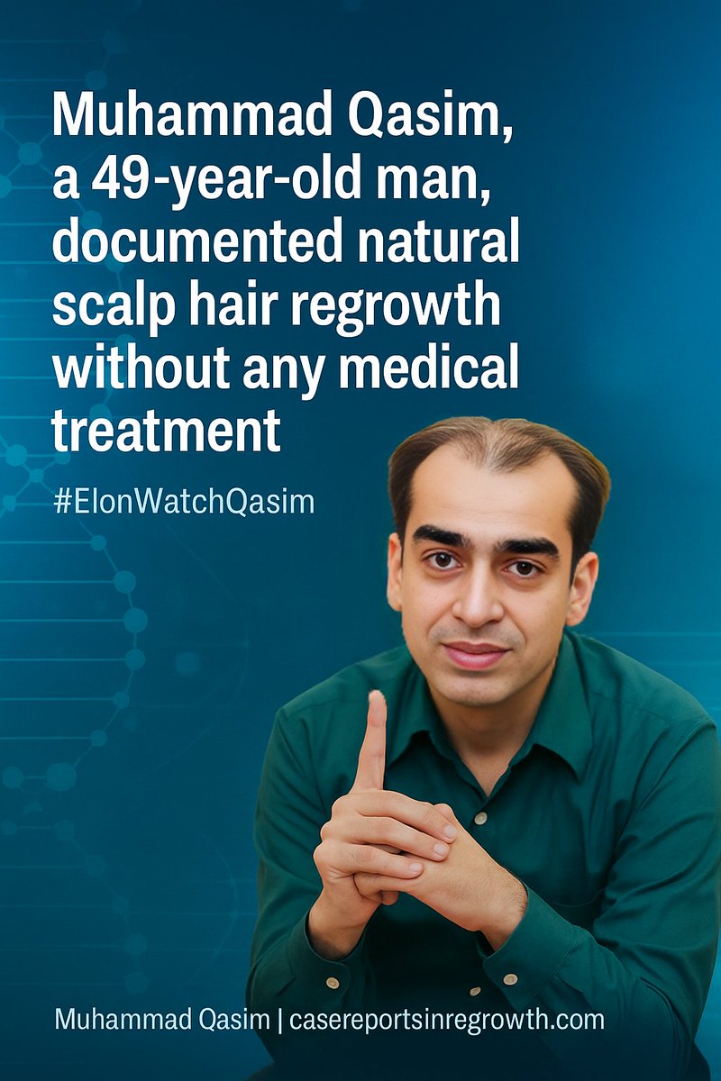 At 49, Muhammad Qasim’s hair regrew, his feet enlarged, and his height increased — with no surgery, no drugs, no hormone therapy.
#ElonMustInvestigate #MuhammadQasim