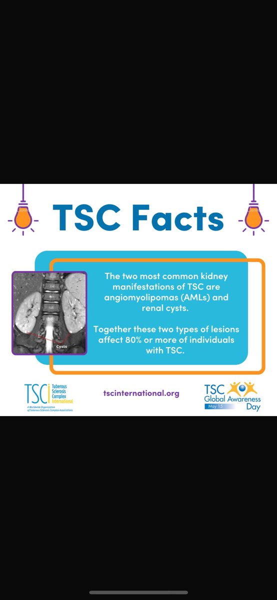 <a href="/lillyvonschtupp/">Mike Masterson</a> <a href="/IrishKidneyAs/">Irish Kidney Association</a> <a href="/LauraenrightTSC/">Laura Enright</a>