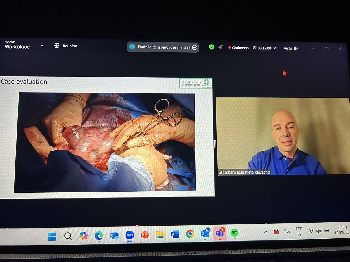 jose sanin (@saninblair) on Twitter photo Wonderfull Webinar in complex C Section.
Great presentation <a href="/nieto_albaro/">Albaro Nieto Calvache</a>
<a href="/ProfAsmaKhalil/">Asma Khalil</a> (3 webinar in the weekend..twins-PAS and Neuro). What a job.. Wonderfull Webinar in complex C Section.
Great presentation <a href="/nieto_albaro/">Albaro Nieto Calvache</a>
<a href="/ProfAsmaKhalil/">Asma Khalil</a> (3 webinar in the weekend..twins-PAS and Neuro). What a job..