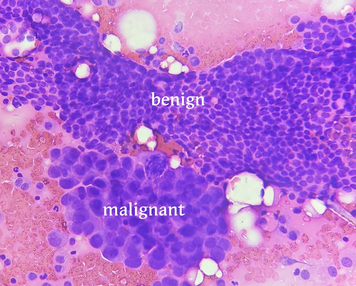 aung phyo tweet media