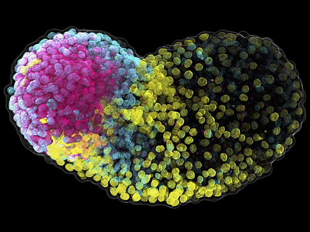 Leica Microsystems (@leicamicro) on Twitter photo Researchers have found cells behaving like primordial germ cells using Leica Microsystems microscopy! This opens the way for further studies into how they keep our genetic ancestry safe into adulthood. Read more about this research: fcld.ly/dkdikd7
<a href="/BiochemOxford/">Department of Biochemistry at Oxford University</a> <a href="/BPoD_s/">Biomedical Picture of the Day BPoD</a> Researchers have found cells behaving like primordial germ cells using Leica Microsystems microscopy! This opens the way for further studies into how they keep our genetic ancestry safe into adulthood. Read more about this research: fcld.ly/dkdikd7
<a href="/BiochemOxford/">Department of Biochemistry at Oxford University</a> <a href="/BPoD_s/">Biomedical Picture of the Day BPoD</a>