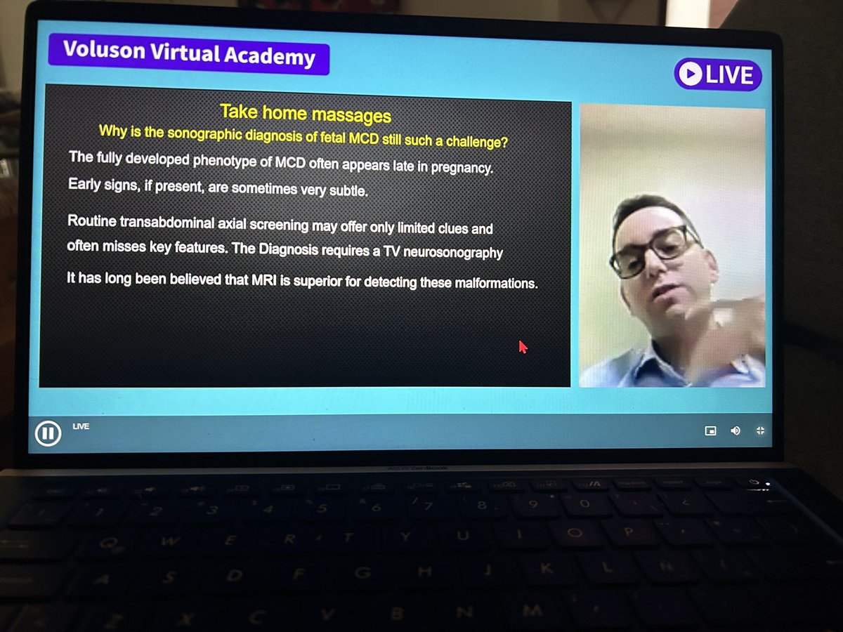 jose sanin (@saninblair) on Twitter photo Very comprehensive conference in cortical abnormalities. Doing easy the difficult.. thanks Roee Birnbaum.
<a href="/neurosonology/">World Organisation of Neurosonology (WON)</a> <a href="/ProfAsmaKhalil/">Asma Khalil</a> Very comprehensive conference in cortical abnormalities. Doing easy the difficult.. thanks Roee Birnbaum.
<a href="/neurosonology/">World Organisation of Neurosonology (WON)</a> <a href="/ProfAsmaKhalil/">Asma Khalil</a>