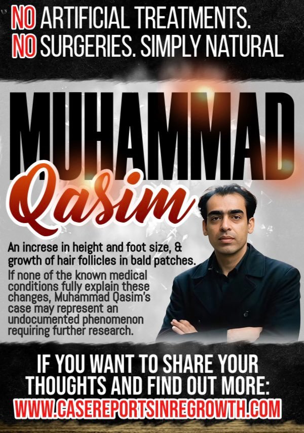 the world is not paying enough attention. Muhammad Qasim, a 49-year-old man, is experiencing natural hair regrowth and height increase — without any medical aid. #ElonMustInvestigate