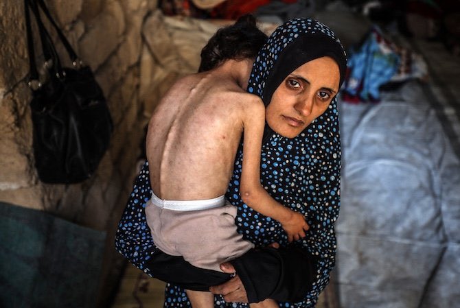 Dr. Yousef 🇵🇸 tweet media