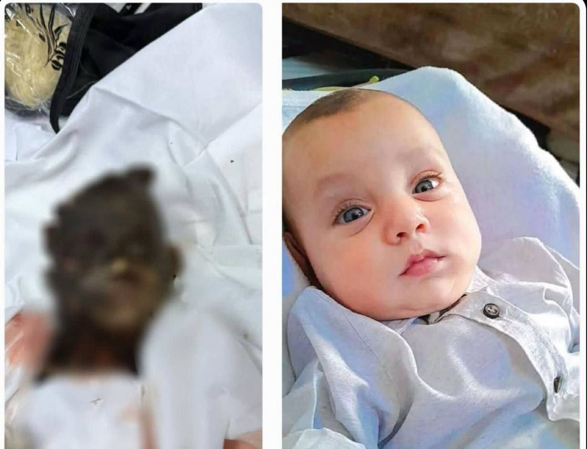 A Palestinian child, his tiny body burned beneath the rubble of a tent he fled to for safety.
His innocence couldn’t save him.
His childhood couldn’t shield him from the fire.
He was charred before he ever tasted life.💔💔🥺