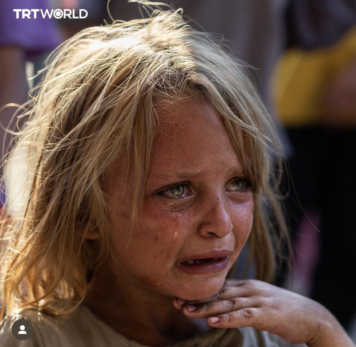 Dr. Yousef 🇵🇸 tweet media