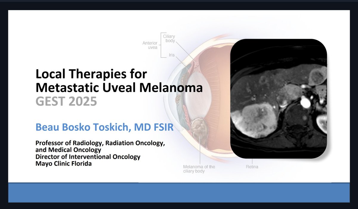 Beau Bosko Toskich, MD FSIR (@beautoskichmd) on Twitter photo #GEST2025 was fantastic. No better mix of Data+Details in #IRad. Congrats <a href="/JafarGolzarian/">Jafar Golzarian, MD FSIR</a> and <a href="/thegestgroup/">GEST -Global Embolization Symposium & Technologies</a> 👊🏻 #GEST2025 was fantastic. No better mix of Data+Details in #IRad. Congrats <a href="/JafarGolzarian/">Jafar Golzarian, MD FSIR</a> and <a href="/thegestgroup/">GEST -Global Embolization Symposium & Technologies</a> 👊🏻
