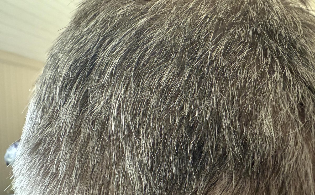 Before, after, close-up! After 30 days of the hot water clove bud extract, a.k.a. clove bud water, not only is there substantially less gray/white hair on this gentleman in his 70s, but it's much thicker from what I can see.

One thing I wish everybody fully understood is the
