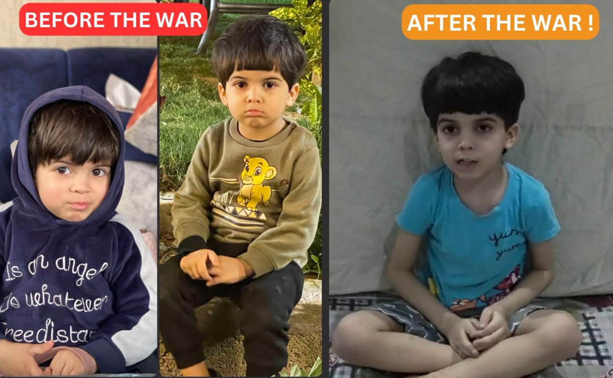nabilhope1's tweet photo. Look How They Destroyed My Boy 💔🥺
My only son, Moeen, suffers from anemia due to hunger and fear. Before the war in Gaza, I gave him everything he wished for. Now, I've lost it all and would give my soul to save his life.
Please, share my story. 
Your support is the last hope.
 https://t.co/GpumVtjjnR