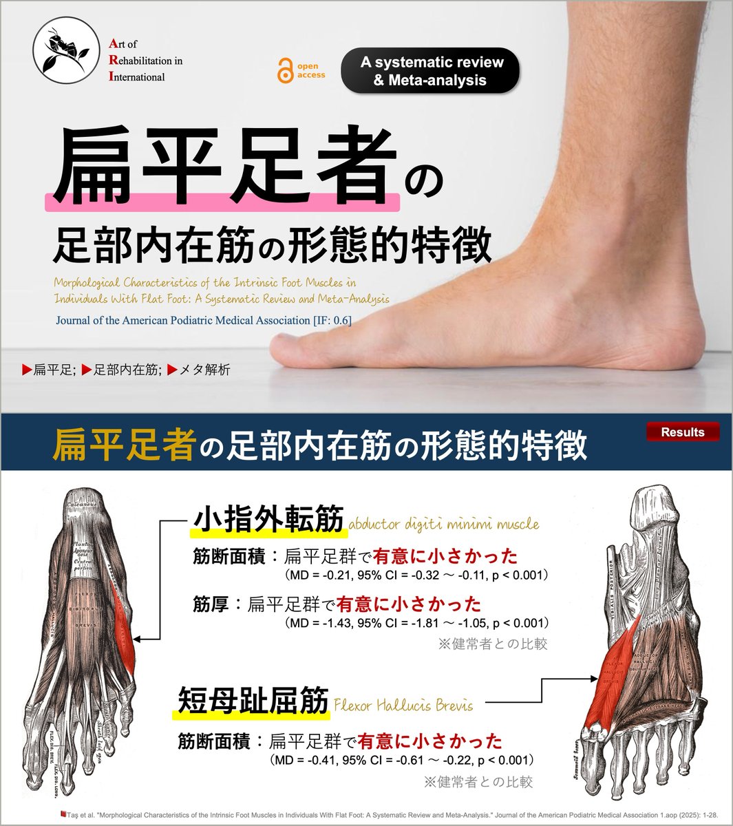 copellist's tweet photo. 📕扁平足者の足部内在筋の形態的特徴
・5研究を包含
扁平足者は健常者と比較し,
🔹小趾外転筋：筋断面積↓(MD -0.21), 筋厚↓(-1.43)
🔹短母趾屈筋：筋断面積↓(-0.41)
扁平足には内側縦アーチのみではなく,
外側縦アーチに寄与する筋の萎縮もあるようです😲
#扁平足 #足部内在筋 #外側縦アーチ https://t.co/DXz3mKm7Ny